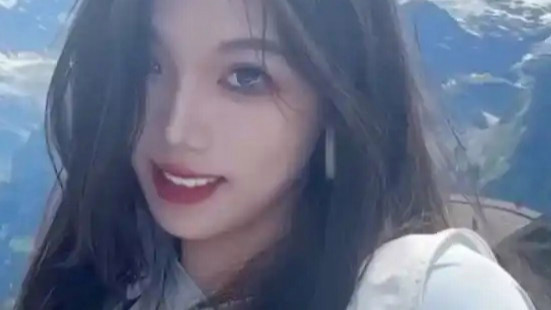女孩正颌手术被做反 当事医生已停诊热搜配图